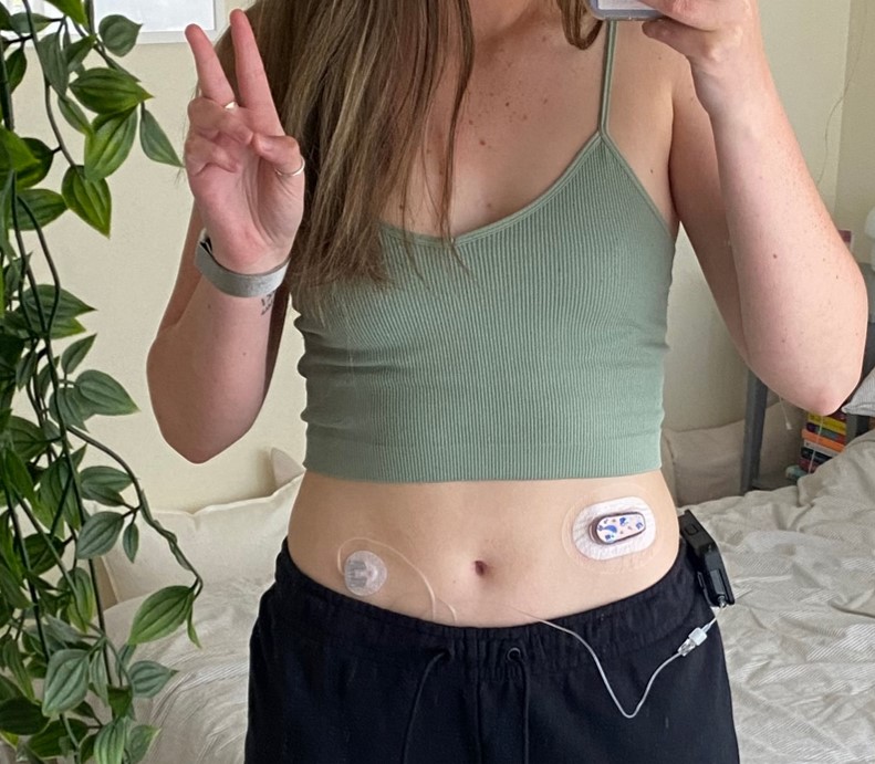 Picture of diabetes tech