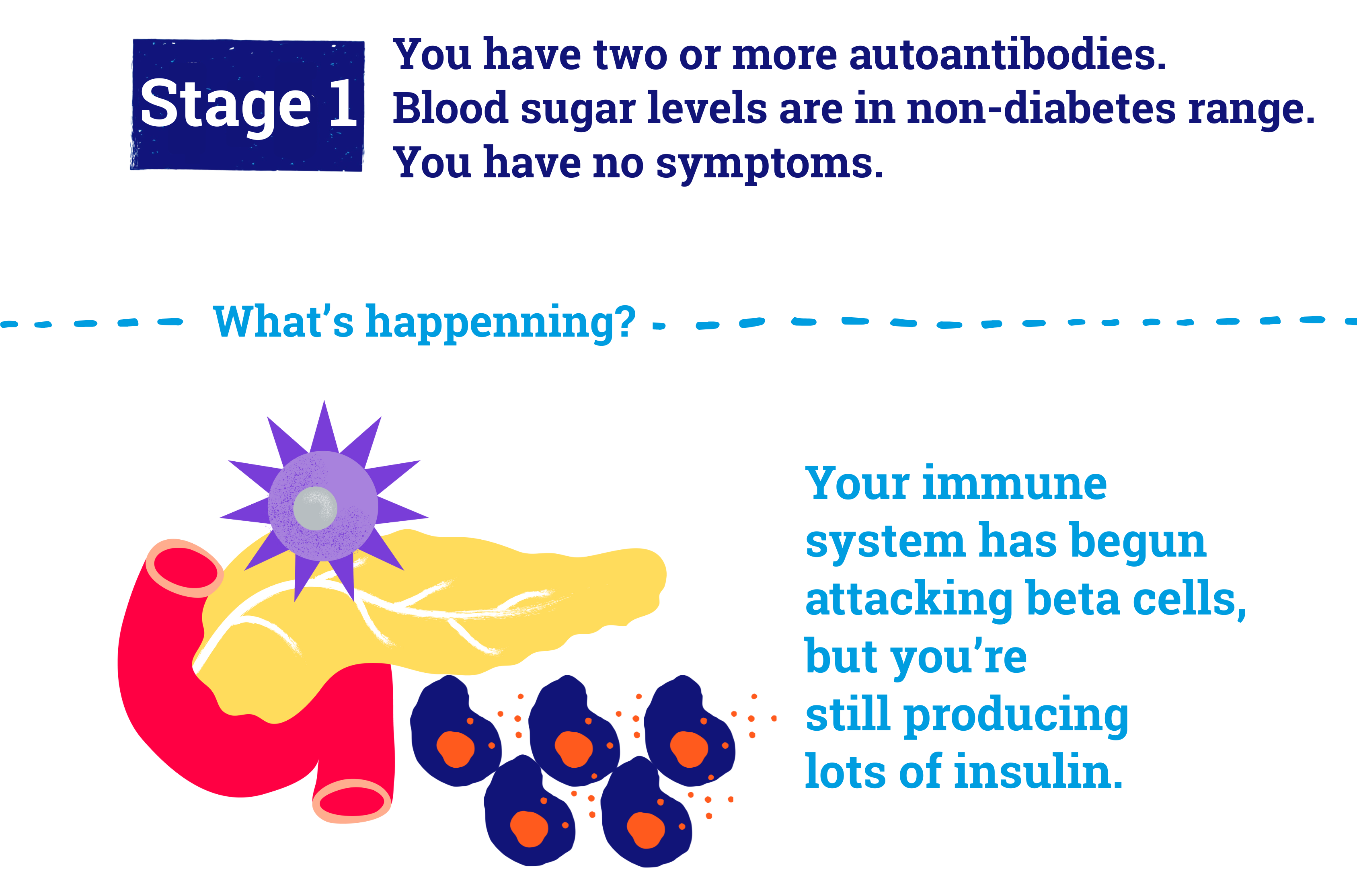 In stage 1, blood sugar levels are in the non-diabetes range and you have no symptoms.