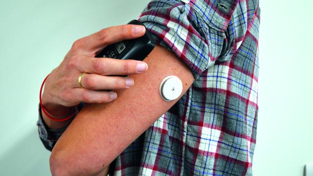 Man pointing to glucose monitor in his arm