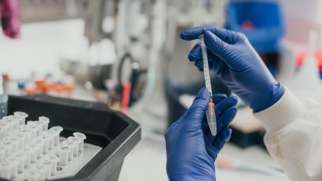 Image showing two hands in blue gloves holding a pipette
