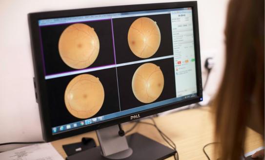 A healthcare professional looking at photos from a retinopathy screen